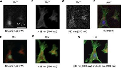 Few-Photon Spectral Confocal Microscopy for Cell Imaging Using Superconducting Transition Edge Sensor